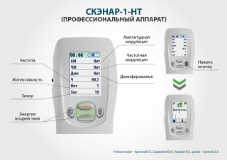 СКЭНАР-1-НТ (исполнение 01)  в Рязани купить Скэнар официальный сайт - denasvertebra.ru 